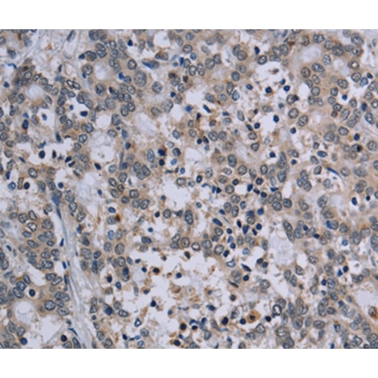 Immunohistochemistry - TP53AIP1 Antibody from Signalway Antibody (37791) - Antibodies.com