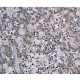 Immunohistochemistry - TP53AIP1 Antibody from Signalway Antibody (37791) - Antibodies.com