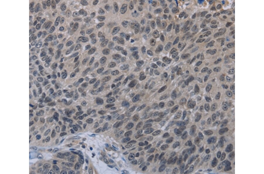 Immunohistochemistry - TP53AIP1 Antibody from Signalway Antibody (37791) - Antibodies.com