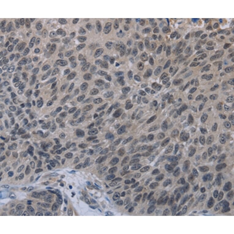 Immunohistochemistry - TP53AIP1 Antibody from Signalway Antibody (37791) - Antibodies.com