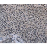 Immunohistochemistry - TP53AIP1 Antibody from Signalway Antibody (37791) - Antibodies.com