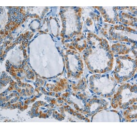 Immunohistochemistry - PPARGC1B Antibody from Signalway Antibody (37819) - Antibodies.com