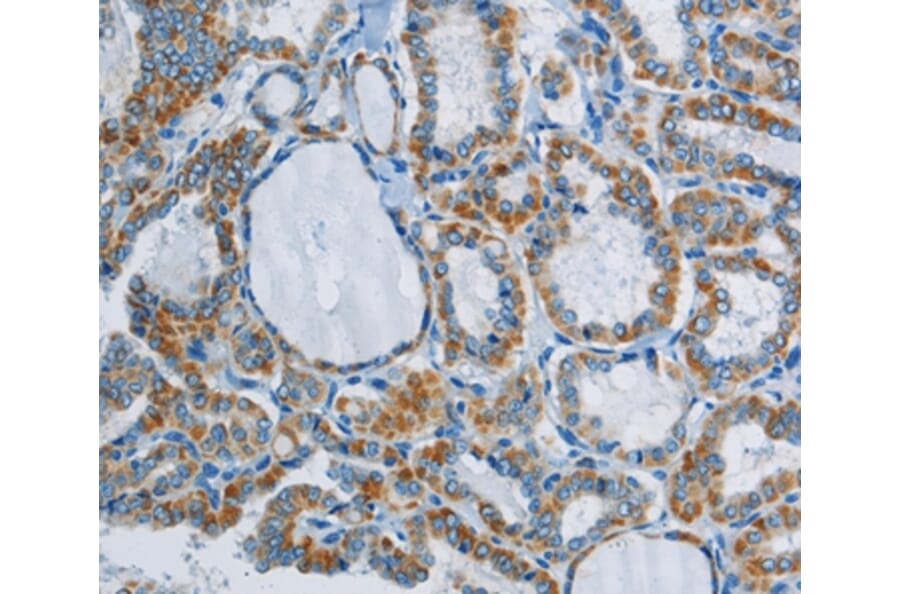 Immunohistochemistry - PPARGC1B Antibody from Signalway Antibody (37819) - Antibodies.com