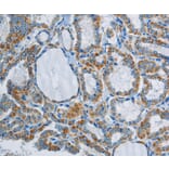 Immunohistochemistry - PPARGC1B Antibody from Signalway Antibody (37819) - Antibodies.com