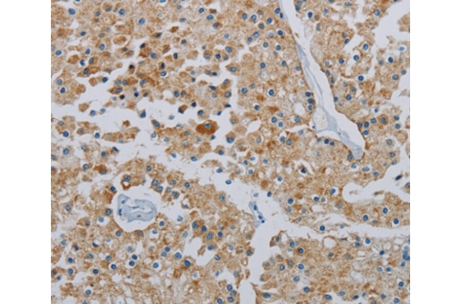 Immunohistochemistry - PPARGC1B Antibody from Signalway Antibody (37819) - Antibodies.com