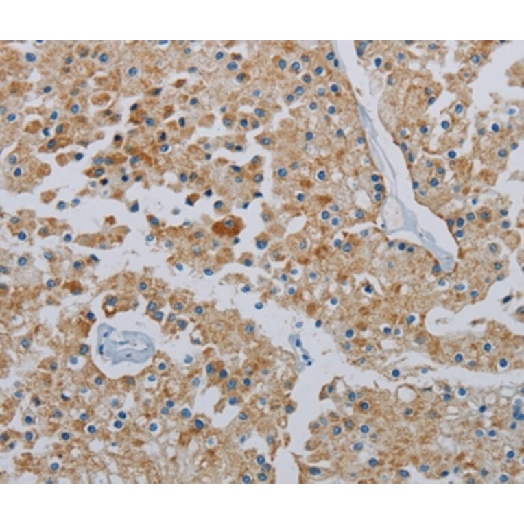 Immunohistochemistry - PPARGC1B Antibody from Signalway Antibody (37819) - Antibodies.com