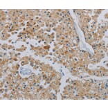 Immunohistochemistry - PPARGC1B Antibody from Signalway Antibody (37819) - Antibodies.com