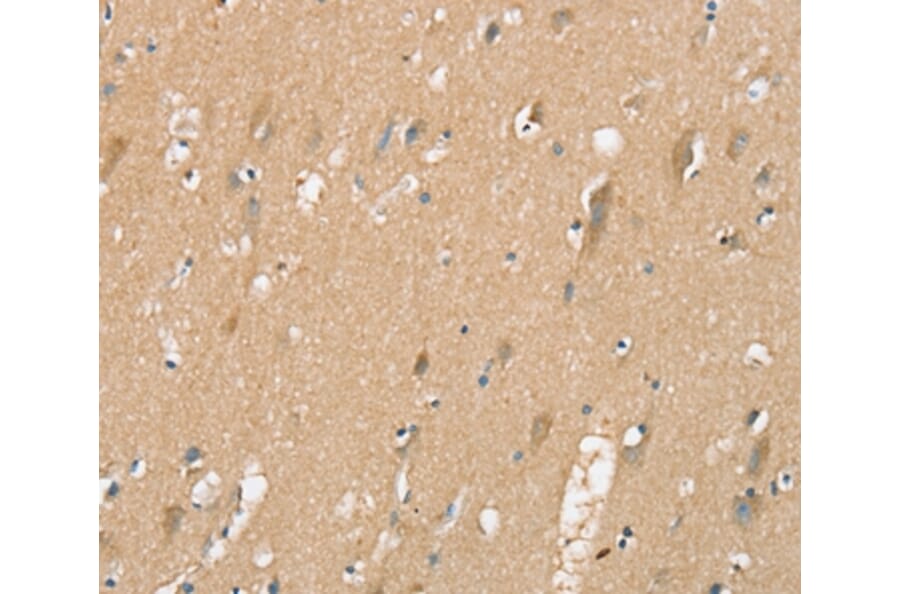 Immunohistochemistry - SIGLEC10 Antibody from Signalway Antibody (37921) - Antibodies.com