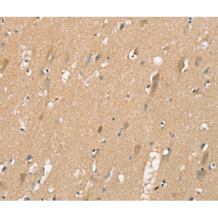 Immunohistochemistry - SIGLEC10 Antibody from Signalway Antibody (37921) - Antibodies.com