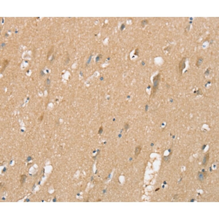 Immunohistochemistry - SIGLEC10 Antibody from Signalway Antibody (37921) - Antibodies.com