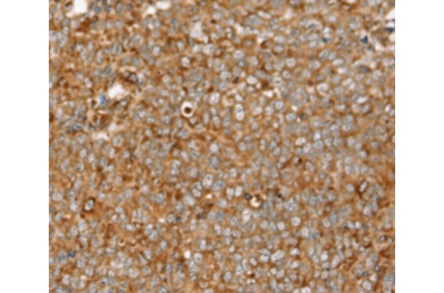Immunohistochemistry - SIGLEC11 Antibody from Signalway Antibody (37923) - Antibodies.com
