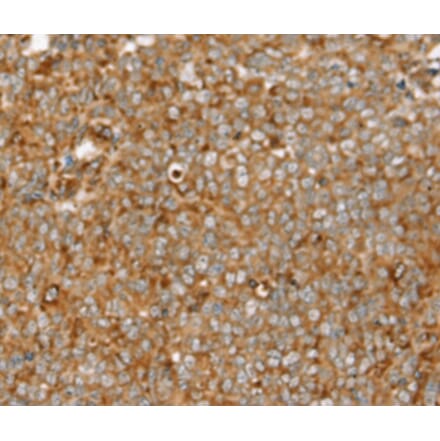 Immunohistochemistry - SIGLEC11 Antibody from Signalway Antibody (37923) - Antibodies.com