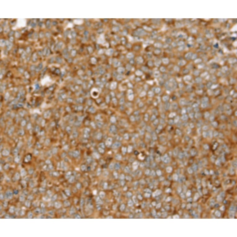 Immunohistochemistry - SIGLEC11 Antibody from Signalway Antibody (37923) - Antibodies.com