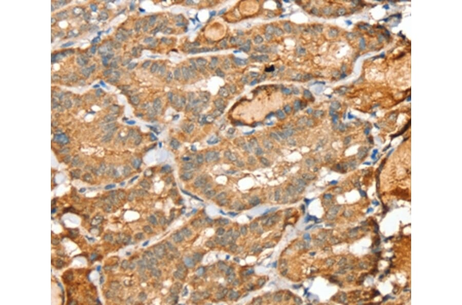 Immunohistochemistry - SIGLEC14 Antibody from Signalway Antibody (37924) - Antibodies.com