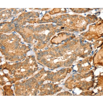 Immunohistochemistry - SIGLEC14 Antibody from Signalway Antibody (37924) - Antibodies.com