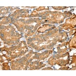Immunohistochemistry - SIGLEC14 Antibody from Signalway Antibody (37924) - Antibodies.com