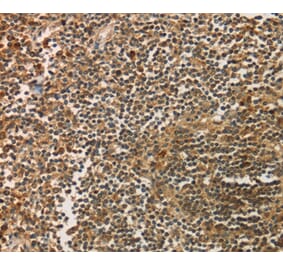 Immunohistochemistry - SIGLEC15 Antibody from Signalway Antibody (37925) - Antibodies.com