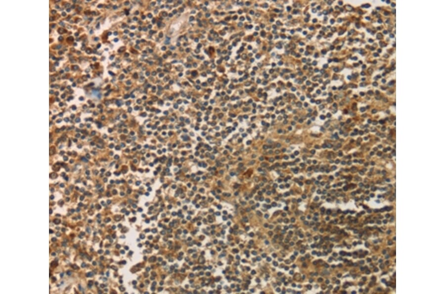 Immunohistochemistry - SIGLEC15 Antibody from Signalway Antibody (37925) - Antibodies.com