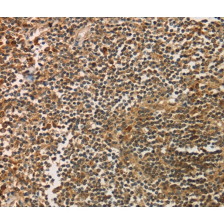 Immunohistochemistry - SIGLEC15 Antibody from Signalway Antibody (37925) - Antibodies.com