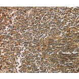 Immunohistochemistry - SIGLEC15 Antibody from Signalway Antibody (37925) - Antibodies.com