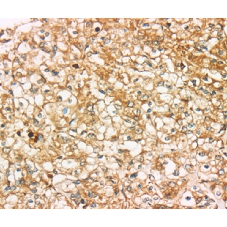 Immunohistochemistry - SIGLEC15 Antibody from Signalway Antibody (37925) - Antibodies.com