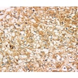 Immunohistochemistry - SIGLEC15 Antibody from Signalway Antibody (37925) - Antibodies.com