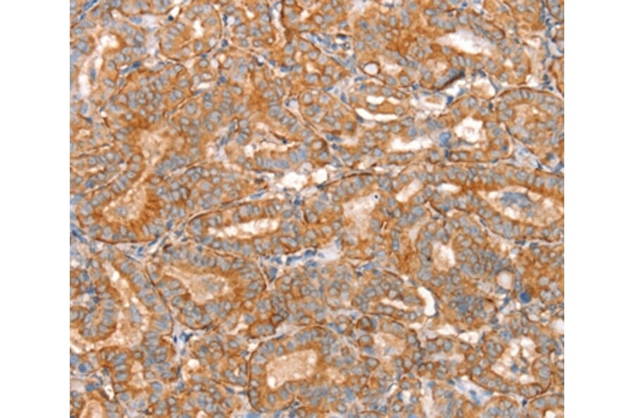 Immunohistochemistry - SLC16A11 Antibody from Signalway Antibody (37931) - Antibodies.com