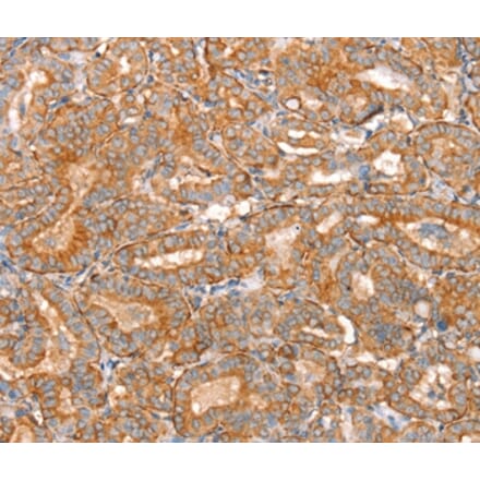 Immunohistochemistry - SLC16A11 Antibody from Signalway Antibody (37931) - Antibodies.com
