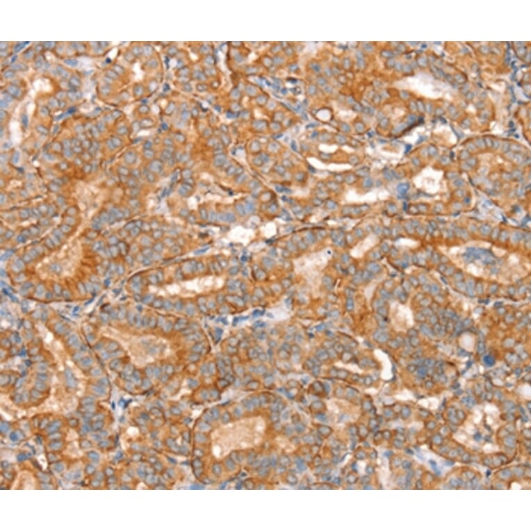 Immunohistochemistry - SLC16A11 Antibody from Signalway Antibody (37931) - Antibodies.com