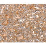 Immunohistochemistry - SLC16A11 Antibody from Signalway Antibody (37931) - Antibodies.com