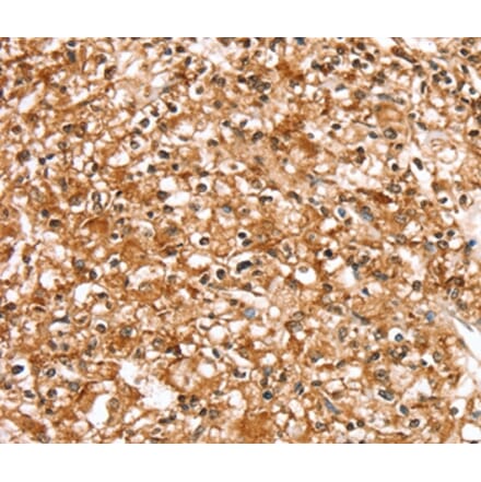 Immunohistochemistry - SLC16A12 Antibody from Signalway Antibody (37932) - Antibodies.com