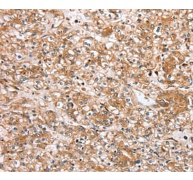 Immunohistochemistry - SLC25A20 Antibody from Signalway Antibody (37934) - Antibodies.com