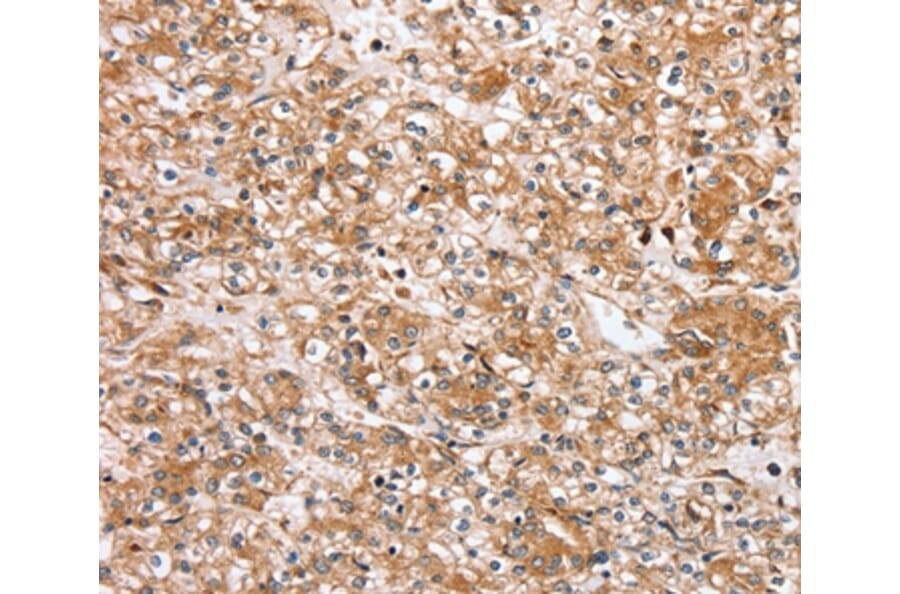 Immunohistochemistry - SLC25A20 Antibody from Signalway Antibody (37934) - Antibodies.com