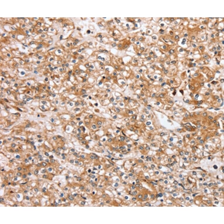Immunohistochemistry - SLC25A20 Antibody from Signalway Antibody (37934) - Antibodies.com