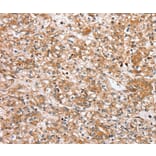 Immunohistochemistry - SLC25A20 Antibody from Signalway Antibody (37934) - Antibodies.com