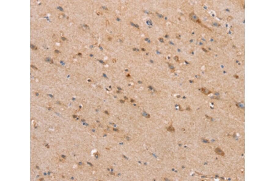 Immunohistochemistry - SLC25A20 Antibody from Signalway Antibody (37934) - Antibodies.com