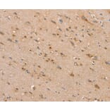 Immunohistochemistry - SLC25A20 Antibody from Signalway Antibody (37934) - Antibodies.com