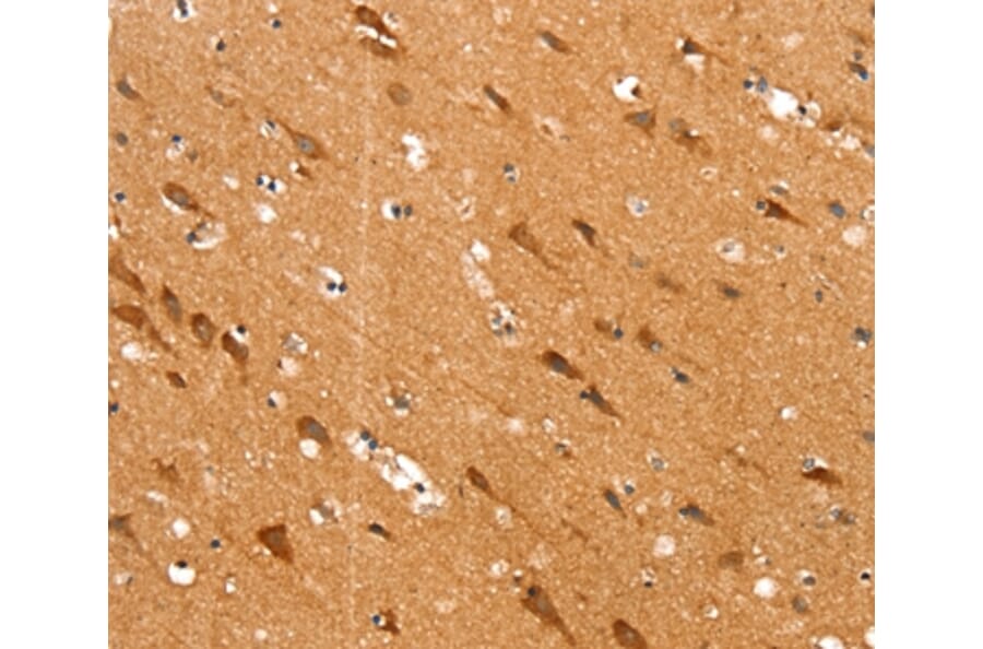 Immunohistochemistry - SLC25A12 Antibody from Signalway Antibody (37935) - Antibodies.com