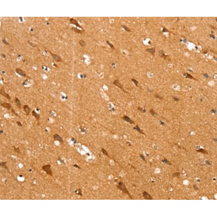 Immunohistochemistry - SLC25A12 Antibody from Signalway Antibody (37935) - Antibodies.com
