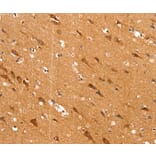 Immunohistochemistry - SLC25A12 Antibody from Signalway Antibody (37935) - Antibodies.com