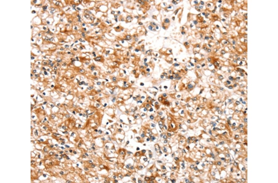 Immunohistochemistry - SLC25A12 Antibody from Signalway Antibody (37935) - Antibodies.com