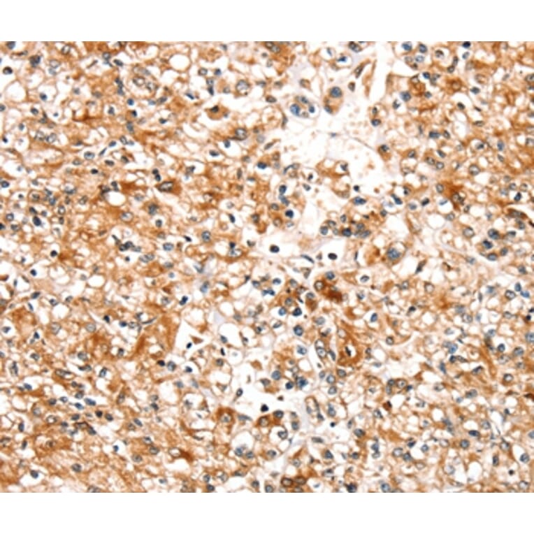 Immunohistochemistry - SLC25A12 Antibody from Signalway Antibody (37935) - Antibodies.com