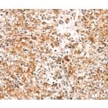 Immunohistochemistry - SLC25A12 Antibody from Signalway Antibody (37935) - Antibodies.com