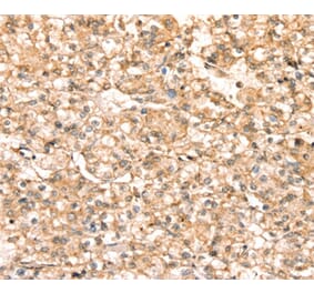 Immunohistochemistry - SLC25A38 Antibody from Signalway Antibody (37936) - Antibodies.com