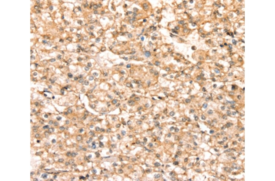 Immunohistochemistry - SLC25A38 Antibody from Signalway Antibody (37936) - Antibodies.com