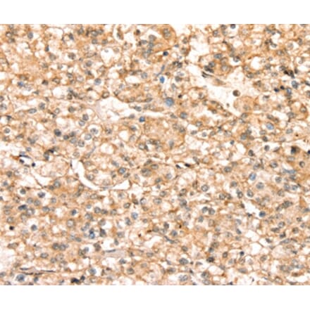Immunohistochemistry - SLC25A38 Antibody from Signalway Antibody (37936) - Antibodies.com