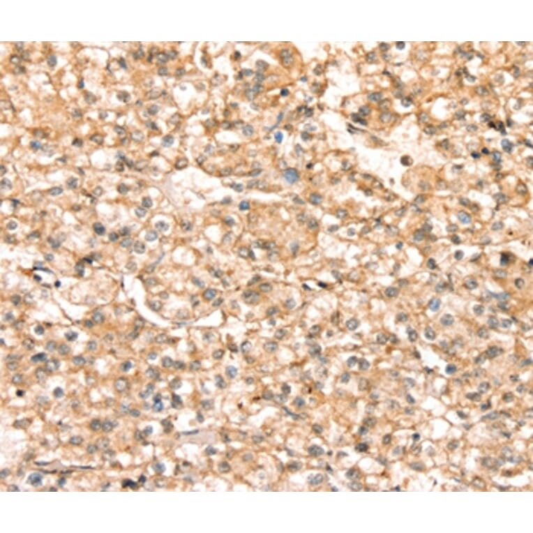 Immunohistochemistry - SLC25A38 Antibody from Signalway Antibody (37936) - Antibodies.com