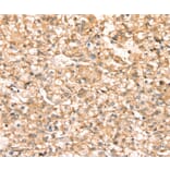 Immunohistochemistry - SLC25A38 Antibody from Signalway Antibody (37936) - Antibodies.com