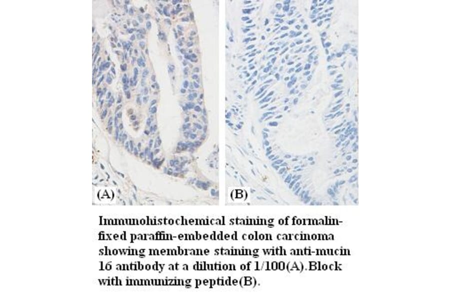 mucin 16 Antibody from Signalway Antibody (39379) - Antibodies.com