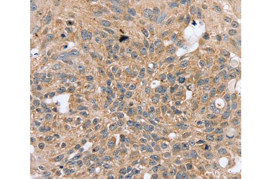 Immunohistochemistry - RASGEF1A Antibody from Signalway Antibody (40070) - Antibodies.com